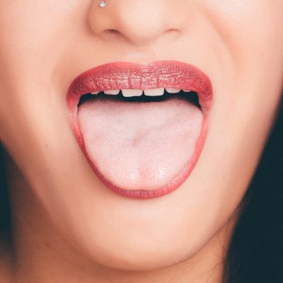 tongue-fat