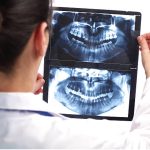 The Importance Of Dental X-Rays
