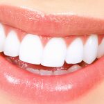 Things To Avoid After Getting Your Teeth Whitened