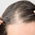 Transformative Touch: How A Hair Transplant Can Boost Your Life