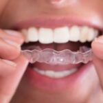 How Occlusal Guards Can Save Your Teeth From Bruxism