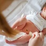 How Can Parents Prepare for Their Baby’s Circumcision Procedure?