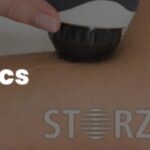 Shockwave Therapy for Orthopedics: A Non-Invasive Treatment Option