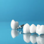 How Dental Crowns Restore Your Smile and Confidence