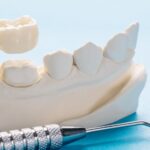 How Dental Crowns Can Restore Your Smile and Oral Function