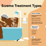 Effective Treatments for Eczema