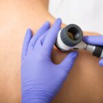 The Importance of Regular Skin Cancer Screenings for Early Detection