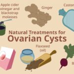 4 Treatments for Cysts