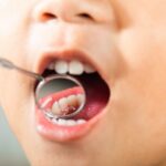 How to Prevent Cavities with Simple Daily Habits 