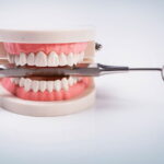 The Benefits of Dental Implants for Restoring Missing Teeth