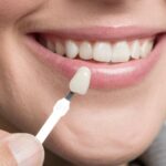 How Cosmetic Dentistry Can Improve Your Smile