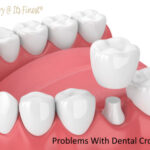 How Dental Crowns Restore Damaged or Decayed Teeth