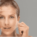 How Chemical Peels Can Restore Your Skin’s Youthful Glow